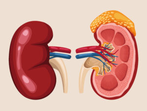 Kidney Infection