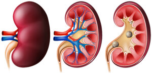 Stages of Kidney Disease